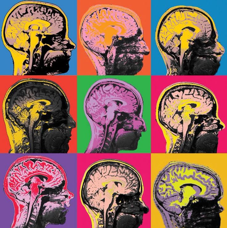 What is Brain Rot?